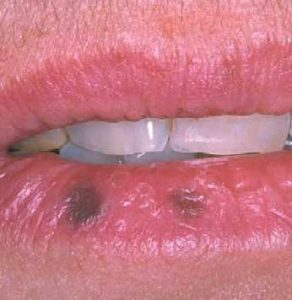 lips pigment
